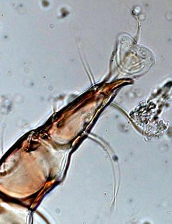Otodectes cyanotis - adult male mite from the ear of a dog.