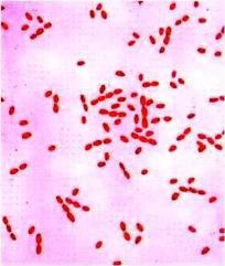 Zoonosis: A disease, primarily of animals, which is transmitted to humans as a result of direct or indirect contact with the infected animal population Brucella Small gram-negative coccobacilli
