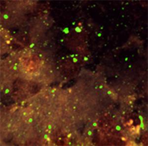 Diagnostic Testing of Brain Material for Rabies General diagnosis by direct fluorescent antibody