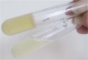 Small, round, cream coloured colonies appeared on nutrient agar after incubation for 24 hours.
