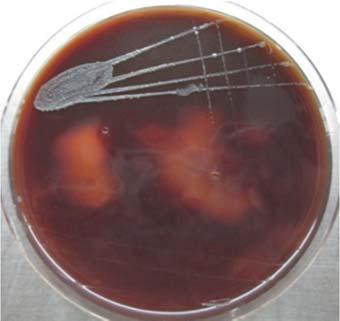 Hence, the 38 isolates tested were confirmed as Staphylococcus spp. (fig. 4). Fig 3: Staph.