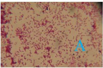 coli on Mac Conkey agar Fig 11: Large, mucoid pink coloured colonies of Klebsiella on Mac conkey agar Fig 8:
