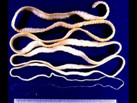 Schistosoma haematobium,