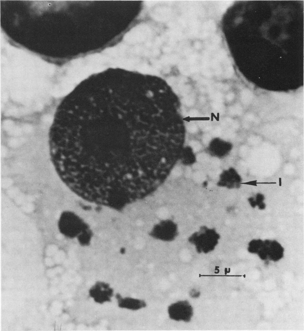 VOL. 7, 1973 ULTRASTRUCTURE OF E. CANIS 267-1 0 m.n.0 I 161W FIG. 2. Numerous inclusions of E. canis (I) in the cytoplasm of a monocyte in infected cell cultures. Nucleus of monocyte (N).