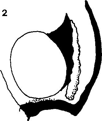 plate of male; 6 - penis valve. Fig. 7: Cephalcia alashanica (Gussakovskij), penis valve of a male from Venetian Prealps (Italy). Scale bar = 1 mm (Figs 1-5), 0.1 mm (Figs 6-7). sockets 0.